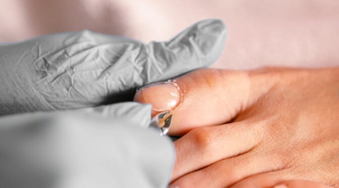 close up of a person getting pedicure done