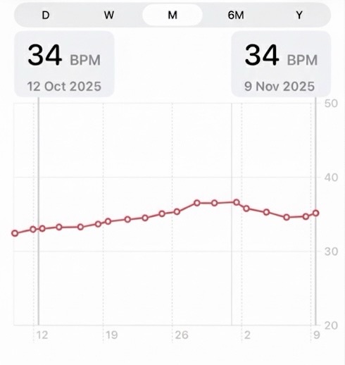 Heart Rate Recovery with Zone 2 running over a month